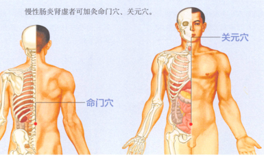 慢性腸炎艾灸