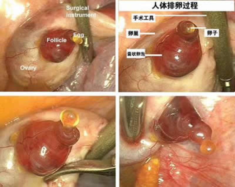 首次拍得人類排卵的過(guò)程