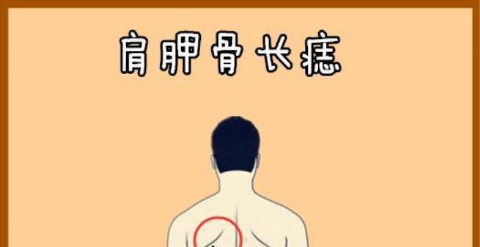 肩膀代表什么樣的運勢呢 男人肩膀上有痣代表什么