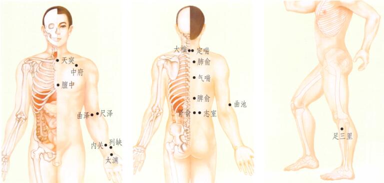 哮喘刮痧