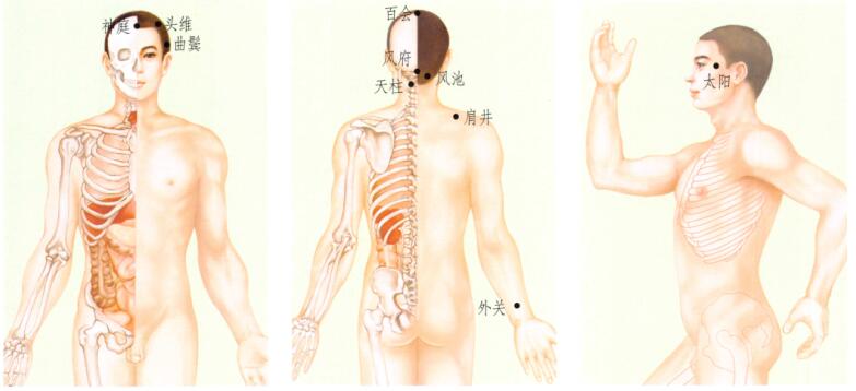 頭痛刮痧