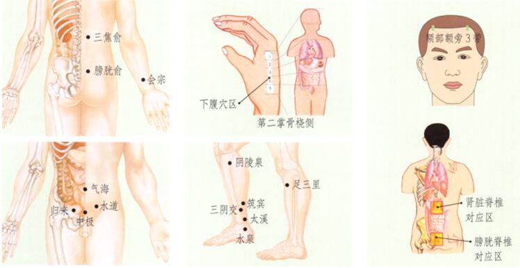 泌尿系感染刮痧