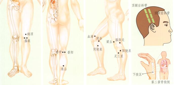 膝關(guān)節(jié)痛刮痧部位