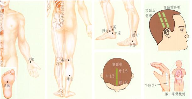 足跟痛刮痧