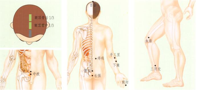 痔瘡刮痧