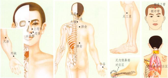 過敏性鼻炎刮痧