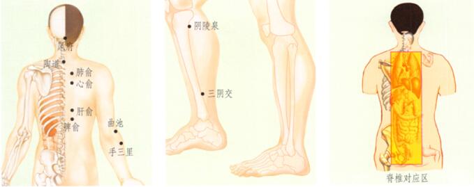 濕疹刮痧