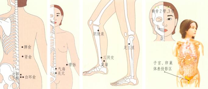 帶下病(盆腔炎)刮痧